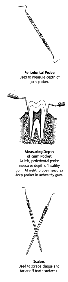 Dental Tools